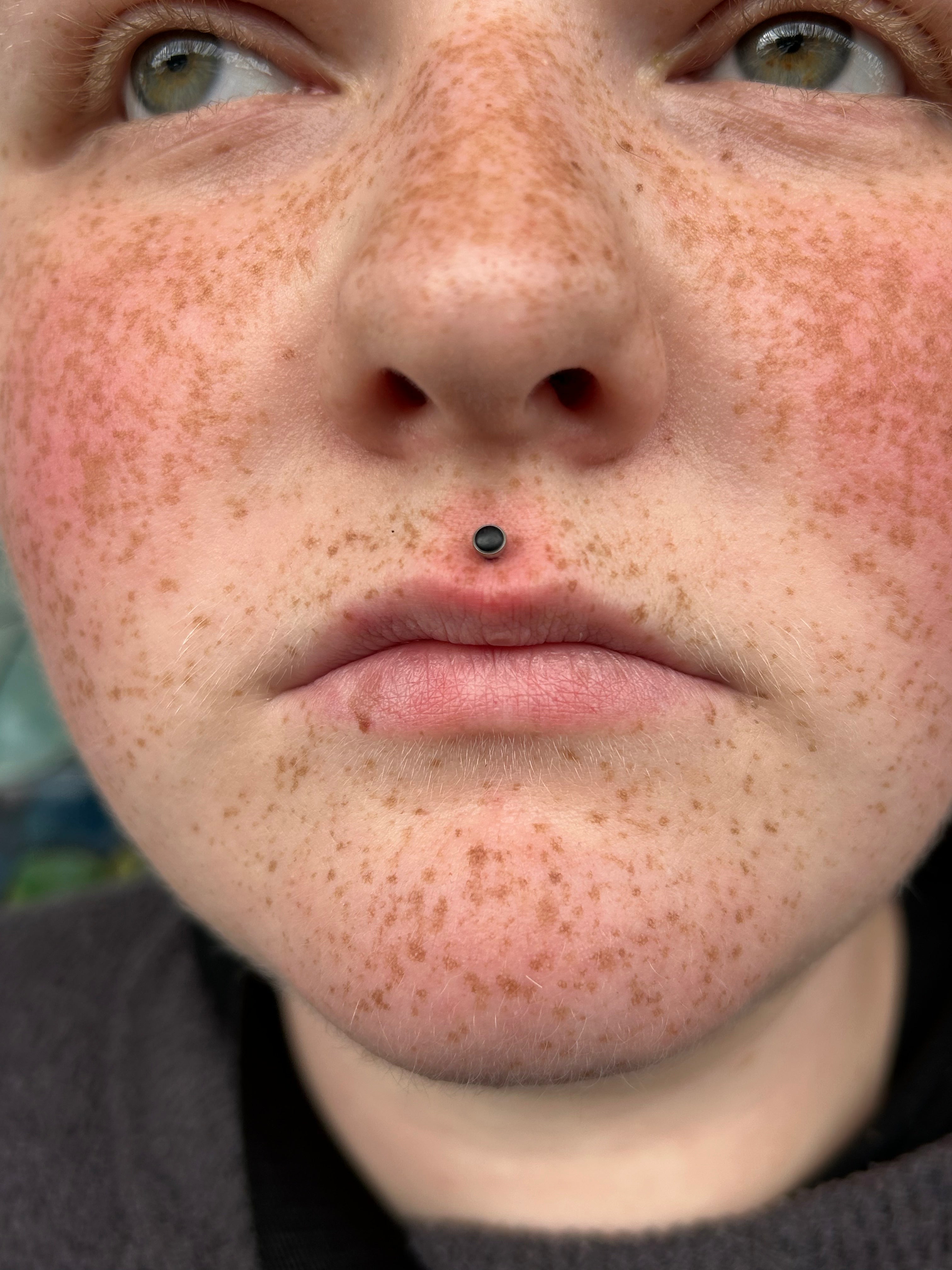 Philtrum/Medusa Piercing